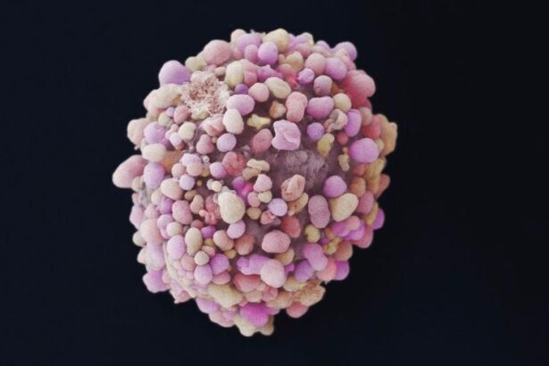 el-desconocido-cancer-de-mama-en-hombres:-los-tumores-se-detectan-en-fases-avanzadas