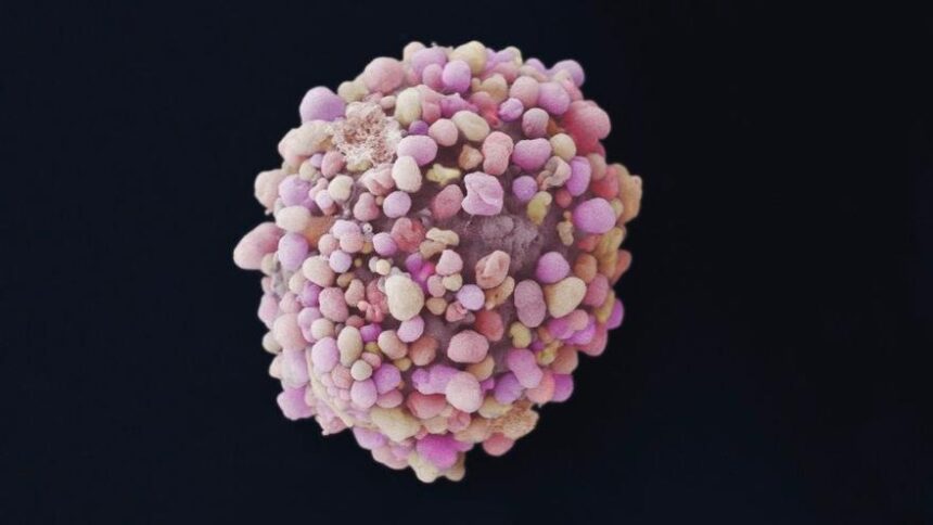 el-desconocido-cancer-de-mama-en-hombres:-los-tumores-se-detectan-en-fases-avanzadas