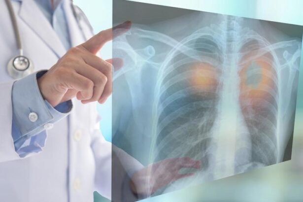 un-farmaco-para-el-cancer-de-pulmon-mas-frecuente-reduce-la-tasa-de-progresion-del-tumor-en-un-34%