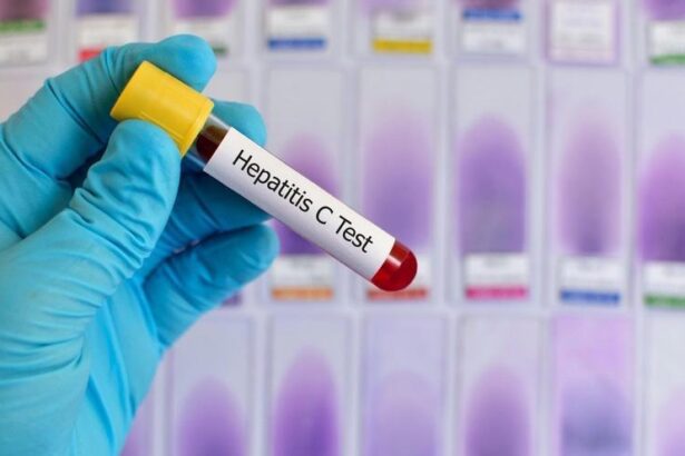 inteligencia-artificial-y-‘big-data’-para-buscar-a-espanoles-que-viven-con-hepatitis-c-y-ni-lo-saben