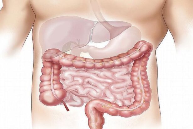 cara-y-cruz-de-los-cribados-de-cancer-de-colon:-pais-vasco,-donde-mas-poblacion-participa-y-andalucia,-donde-menos