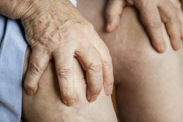 el-misterio-de-la-sarcoidosis,-la-enfermedad-rara-que-provoca-cansancio-y-dolor-articular