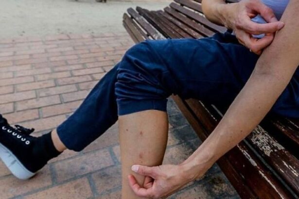 sarna:-los-dermatologos-alertan-de-la-ola-de-contagios-y-el-«fracaso»-de-los-tratamientos-para-la-enfermedad