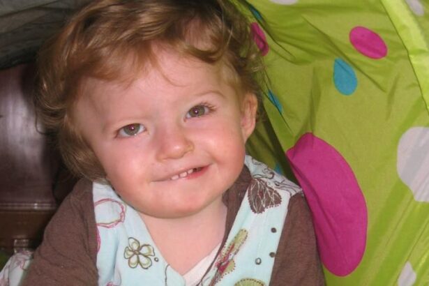 el-reto-de-los-ninos-con-microtia,-la-enfermedad-rara-de-la-oreja-pequena:-«pierden-oportunidad-de-aprender»