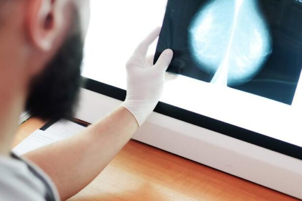 la-federacion-espanola-de-cancer-de-mama-pide-realizar-cribados-tambien-a-los-hombres