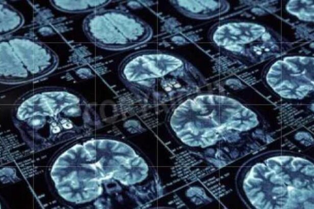 asi-es-la-terapia-que-prolonga-la-vida-de-pacientes-con-el-cancer-cerebral-mas-agresivo:-«un-claro-avance»