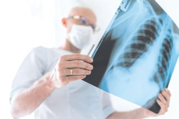 cancer-de-pulmon:-el-hospital-12-de-octubre-detecta-alteraciones-genomicas-tratables-en-72-horas