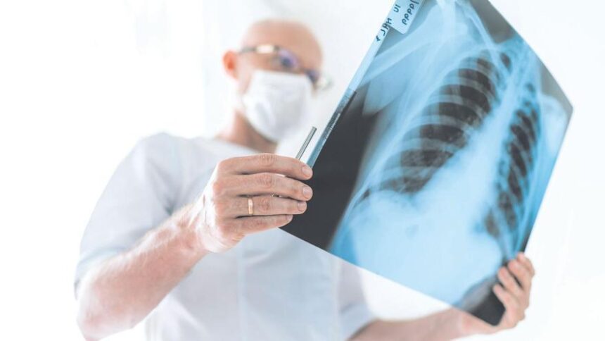cancer-de-pulmon:-el-hospital-12-de-octubre-detecta-alteraciones-genomicas-tratables-en-72-horas
