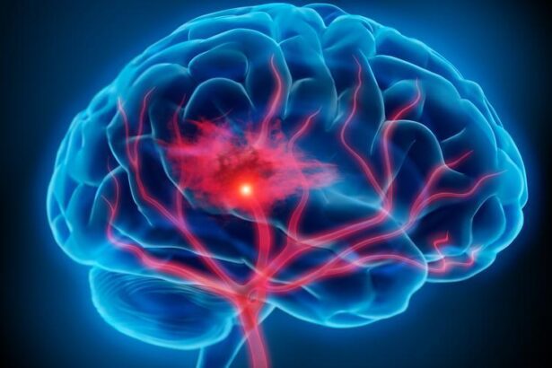 una-tecnica-permite-observar-la-actividad-electrica-de-las-capas-neuronales-tras-sufrir-un-ictus-o-una-hemorragia