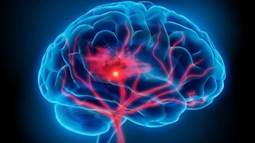 una-tecnica-permite-observar-la-actividad-electrica-de-las-capas-neuronales-tras-sufrir-un-ictus-o-una-hemorragia