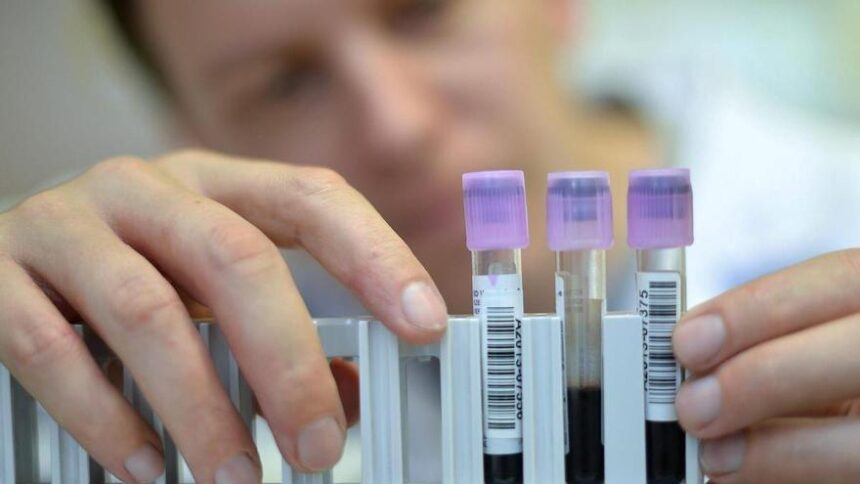 la-biopsia-liquida,-nueva-herramienta-contra-el-cancer-colorrectal:-«detecta-tumores-mas-precoces»