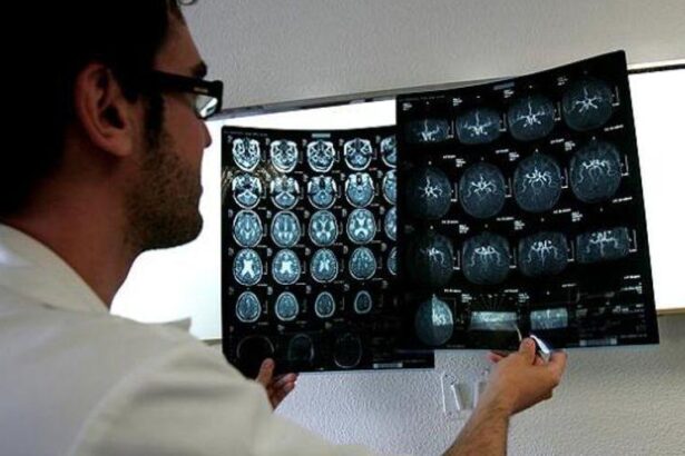 pobreza-y-salud-cerebral:-mas-demencia,-ictus,-alzheimer-o-parkinson-en-personas-con-menos-ingresos