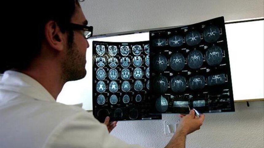 pobreza-y-salud-cerebral:-mas-demencia,-ictus,-alzheimer-o-parkinson-en-personas-con-menos-ingresos