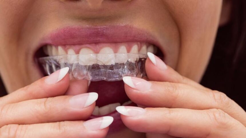 blanqueamientos,-alineadores,-ferulas…-las-estafas-en-redes-preocupan,-y-mucho,-a-los-dentistas