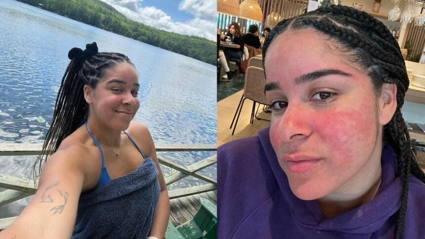 el-colmo-de-maria-botella:-es-instructora-de-natacion,-piscis-y-su-piel-«se-enrojece»-por-una-alergia-al-agua