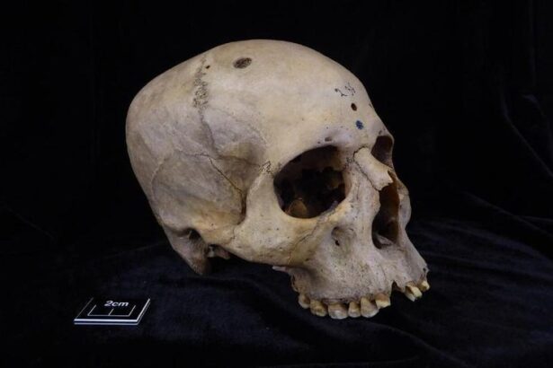 un-craneo-egipcio-de-4.000-anos-muestra-signos-de-un-posible-tratamiento-contra-el-cancer