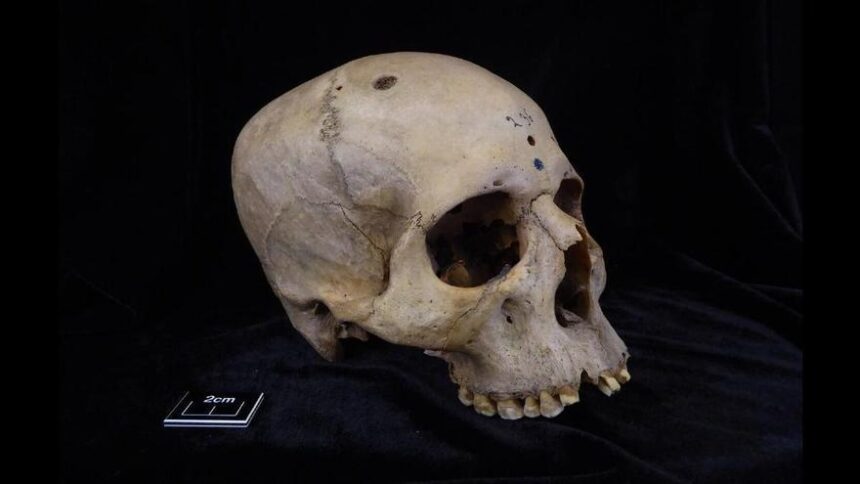 un-craneo-egipcio-de-4.000-anos-muestra-signos-de-un-posible-tratamiento-contra-el-cancer